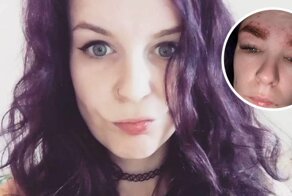 Британка «стала похожа на Квазимодо» после окрашивания бровей