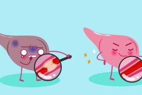 Как вывести токсины из организма? Путь к очищению