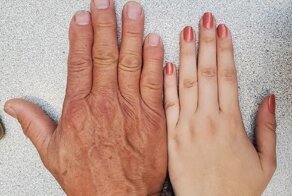 19 человек, которые не стыдятся странностей своего тела