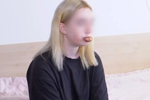 Лайфхак из интернета: 14-летняя девочка решила увеличить губы и сама вколола себе косметическое масло