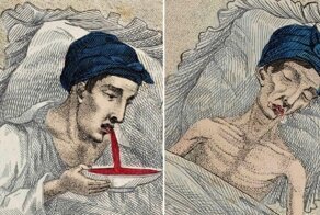 Медики XIX века - об ужасах мастурбации