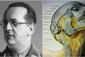 Атлас Пернкопфа: нацистская книга по анатомии, которой до сих пор пользуются хирурги