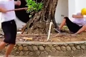 Производственные травмы рабочего