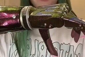 Как работают современные протезы