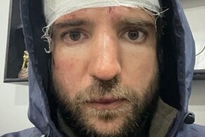 В Каире избили путешественника и блогера из России за фотоснимки из трущоб