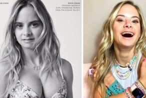 Victoria's Secret представила свою первую модель с синдромом Дауна