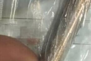 Чудак засунул в половой орган батарейку и удивился, что у него возникли проблемы