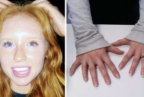 30 человек с редкими особенностями тела