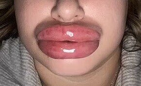 Девушка занялась улучшением внешности и стала похожа на персонажа "Корпорации монстров"