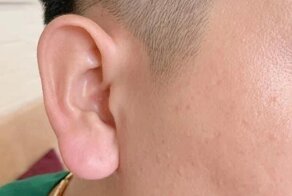 Филлеры в ушах позволяют модникам приблизиться к Будде