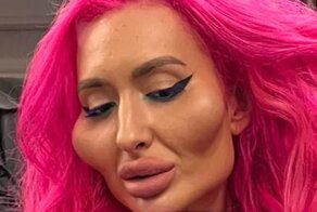 Скуластая красотка продолжает эксперименты с пластикой