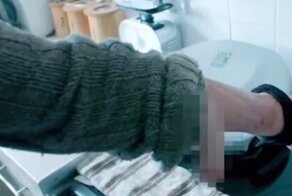 Британец шесть лет прожил с пенисом на руке и теперь его наконец вернули на законное место — между ног