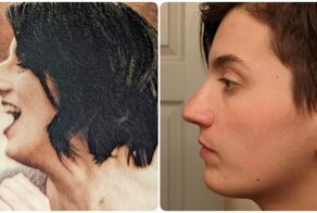 Люди, которые наконец решились на пластическую операцию - и ни на секунду не пожалели