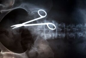 Удивительные рентгеновские снимки, способные шокировать врачей