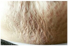 15 шокирующих фото после беременности: ужас, как плата за ребенка