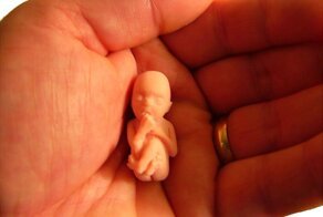 "Это не убийство, а спасение!": дочь Михаила Турецкого оправдалась за аборт из-за пороков плода, но её осудили в Сети