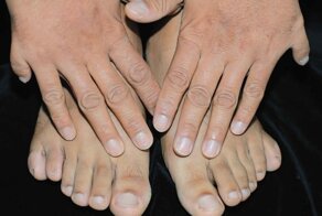 Поразительные аномалии человеческого тела