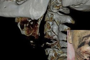 Мужчина покончил с собой, используя бензопилу