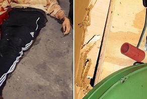 Самоубийство в результате взрыва петарды во рту