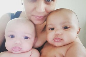 Как сейчас выглядят двухрасовые близнецы, в родство которых никто не верил из-за разного цвета кожи