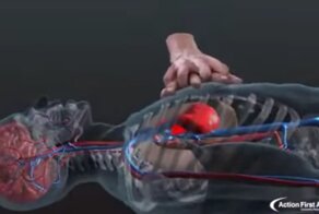 Массаж сердца в 3D