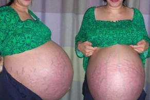 Надя Сулейман знает, как сбросить вес после родов (5 фото)