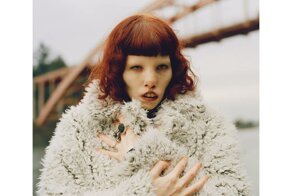 Кейтин Стиклс - модель с синдромом кошачьего глаза, которая покорила мир своей необычной внешностью