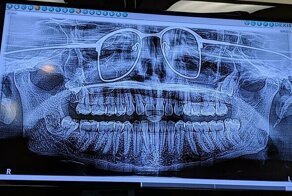 35 человек, которые что-то забыли и поделились забавными последствими