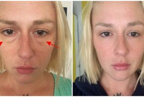 14 людей, которые решились на пластику, чтобы превратить свои "изъяны" в достоинства