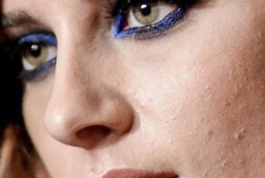 Мешки под глазами и прыщи: как на самом деле выглядит кожа знаменитостей без обработки