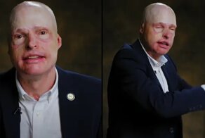 История человека, который сумел выпрыгнуть из горящего самолета и чудом не погиб