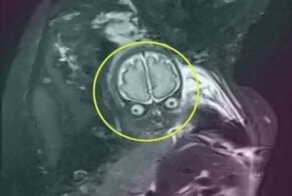 "Весь в отца!": как выглядят внутриутробные снимки детей, сделанные с помощью МРТ