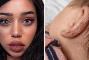 19 любопытных случаев, когда генетика подарила людям необычные фишки внешности