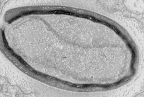 Французские ученые оживили 50 000-летний вирус, который "спал" в вечной мерзлоте