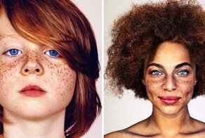 Фотограф делает портреты людей с веснушками, доказывая, что эта особенность — изюминка, а не недостаток