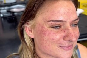 Сетевые тролли осмеяли тату-мастера, нарисовавшего звезды на лице клиентки