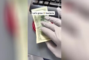 Микробиолог показал как бактерии живут на банкнотах