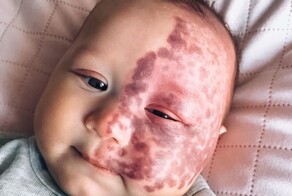 Женщина родила особенного ребёнка, но в соцсетях её осудили за желание помочь новорождённому сыну