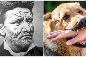 От этих болезней вы бы точно умерли 100 лет назад