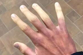 17 редких и удивительных аномалий человеческого тела