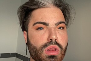 Люди с Синдромом Ваарденбурга, которых щедро одарила генетика