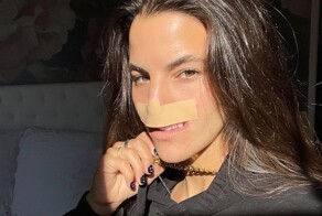 Встреча с питбулем навсегда изменила жизнь девушки, лишив её верхней губы