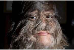 Загадочные болезни в мировой истории