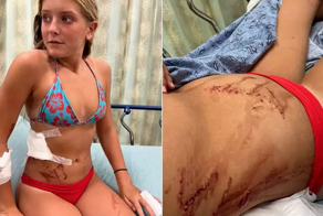 На школьницу дважды напала акула, но девочке удалось отбиться