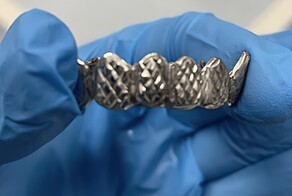 Эпилептик чуть не задохнулся из-за модной накладки на зубы