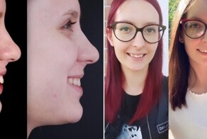 14 людей, которые решили изменить свою улыбку - и не прогадали