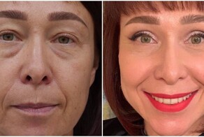 14 людей, которые решились на пластику - и вообще не пожалели