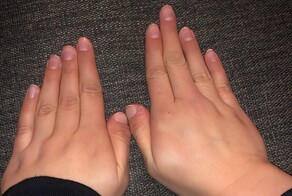 Необычные телесные аномалии, которыми поделились сами их обладатели