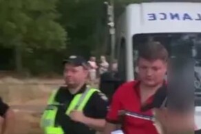 "Я познакомил их с подругой, а они - драться!": в Одессе парню выбили зуб и отметелили за девушку с сюрпризом