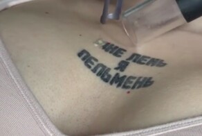 Ошибки молодости: избавление от тату, болезненно, медленно, дорого